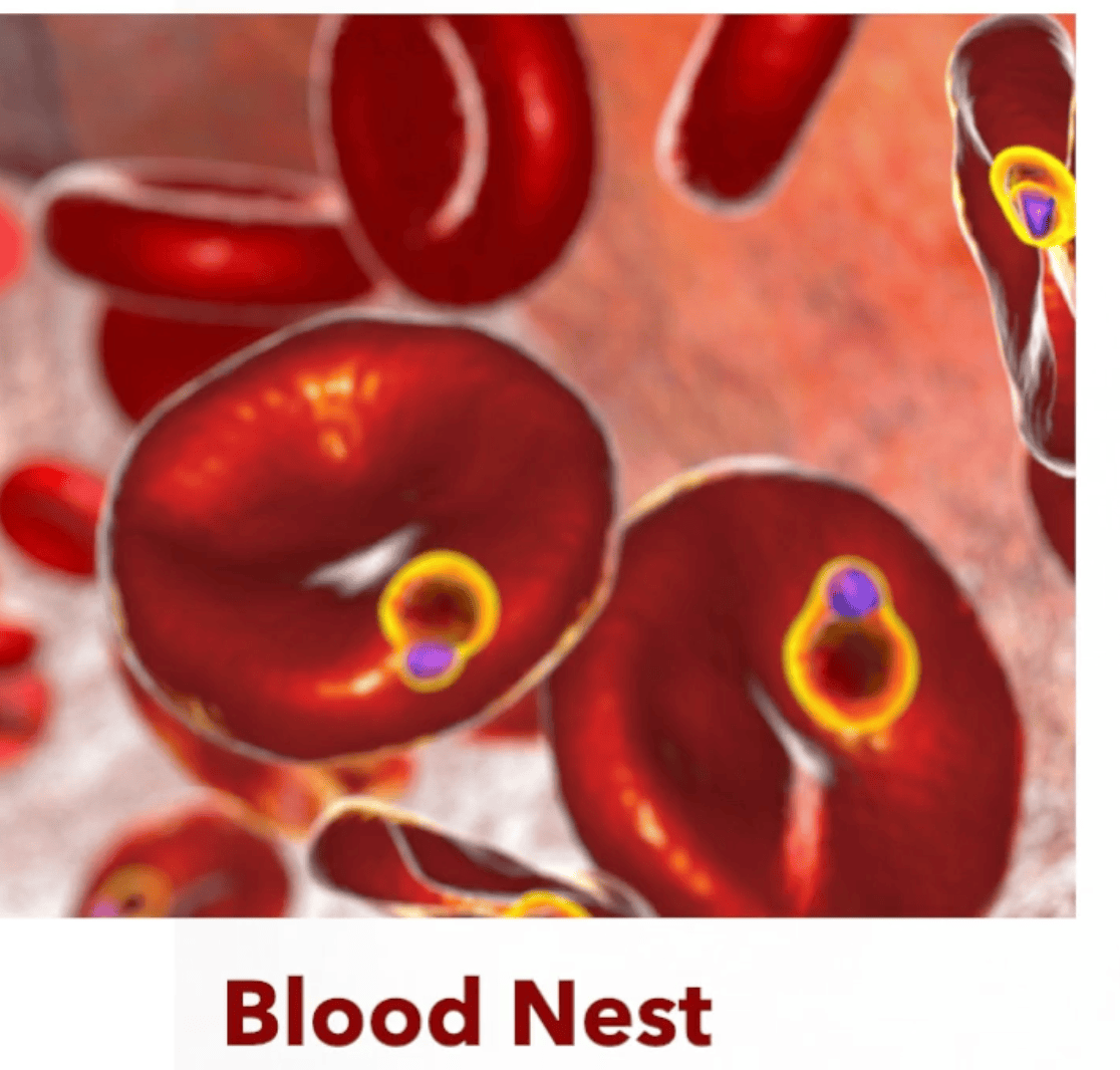 Microscopic image from LymeDr.com titled 'Blood Nest' showing Babesia parasites infecting red blood cells. The visualization clearly displays several red blood cells with characteristic ring-shaped Babesia organisms (appearing as purple bodies surrounded by yellow rings) inside them. This parasitic infection transmitted by ticks invades erythrocytes, causing babesiosis, and is frequently found as a coinfection with Lyme disease. The image demonstrates the intraerythrocytic nature of Babesia that distinguishes it from other tick-borne pathogens.